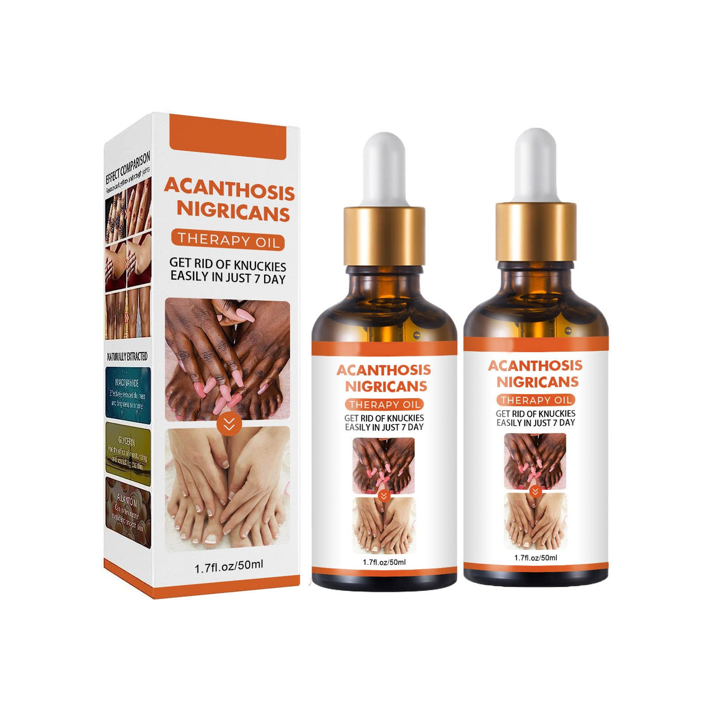 ACANTHOSIS NIGRICANS THERAPY OIL